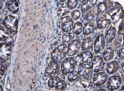 Immunohistochemistry-Paraffin: RPS10 Antibody [NBP1-31357]