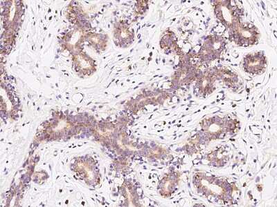 Immunohistochemistry-Paraffin: RPS10 Antibody [NBP2-97622]