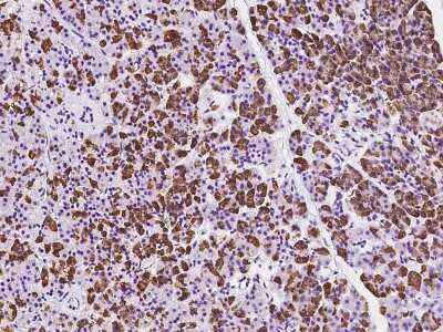 Immunohistochemistry-Paraffin: RPS10 Antibody [NBP2-97622]
