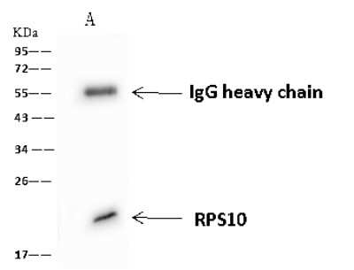 Immunoprecipitation: RPS10 Antibody [NBP2-97622]
