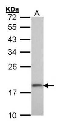 Western Blot: RPS10 Antibody [NBP1-31357]