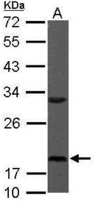 Western Blot: RPS10 Antibody [NBP1-31357]