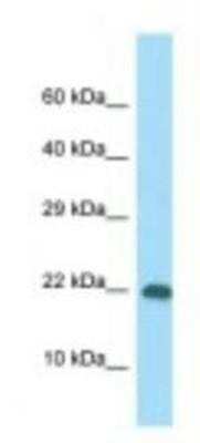 Western Blot: RPS10 Antibody [NBP1-98599]