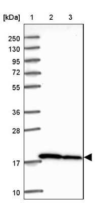 Western Blot: RPS10 Antibody [NBP2-47296]