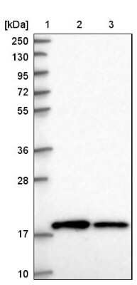 Western Blot: RPS10 Antibody [NBP2-48870]