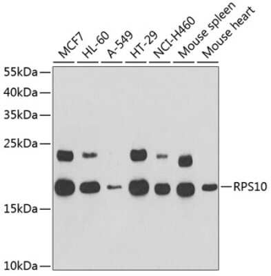 Western Blot: RPS10 AntibodyBSA Free [NBP2-93690]