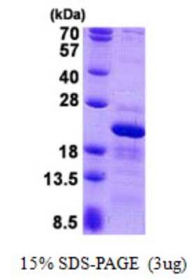 SDS-PAGE: Recombinant Human RPS10 His Protein [NBP2-23427]