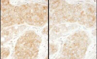 Immunohistochemistry-Paraffin: RPS11 Antibody [NBP2-22288]