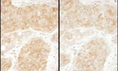 Immunohistochemistry-Paraffin: RPS11 Antibody [NBP2-22289]