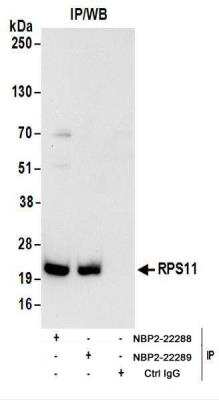 Immunoprecipitation: RPS11 Antibody [NBP2-22288]