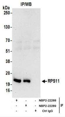 Immunoprecipitation: RPS11 Antibody [NBP2-22289]