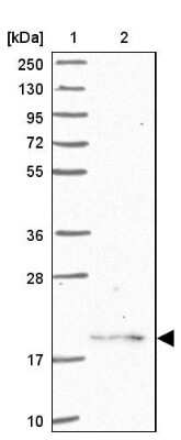 Western Blot: RPS11 Antibody [NBP2-13262]