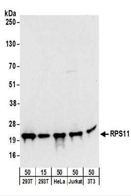 Western Blot: RPS11 Antibody [NBP2-22288]