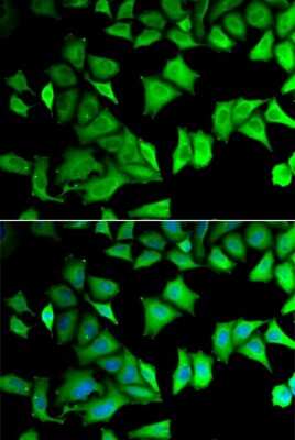 Immunocytochemistry/ Immunofluorescence: RPS12 Antibody - BSA Free [NBP2-94504]