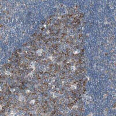 Immunohistochemistry-Paraffin: RPS12 Antibody [NBP1-80805]