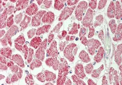 Immunohistochemistry-Paraffin: RPS12 Antibody [NBP2-85667]