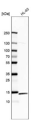 Western Blot: RPS12 Antibody [NBP2-58885]