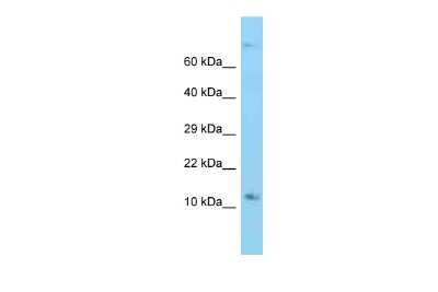 Western Blot: RPS12 Antibody [NBP2-85667]