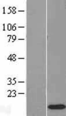 Western Blot: RPS12 Overexpression Lysate [NBL1-15557]