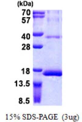 SDS-PAGE: Recombinant Human RPS12 His Protein [NBP2-23428]