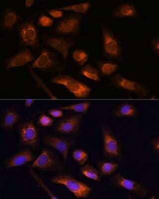 Immunocytochemistry/ Immunofluorescence: RPS13 Antibody - Azide and BSA Free [NBP2-93953]