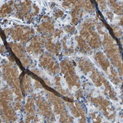 Immunohistochemistry-Paraffin: RPS13 Antibody [NBP1-92350]