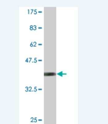 Western Blot: RPS14 Antibody (1B3) [H00006208-M01]