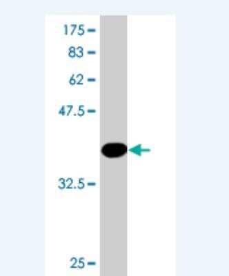 Western Blot: RPS14 Antibody (2B1) [H00006208-M03]