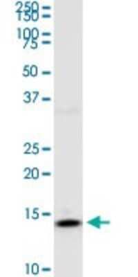 Western Blot: RPS14 Antibody (3G5) [H00006208-M05]