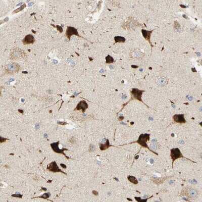 Immunohistochemistry-Paraffin: RPS14 Antibody [NBP1-84847]