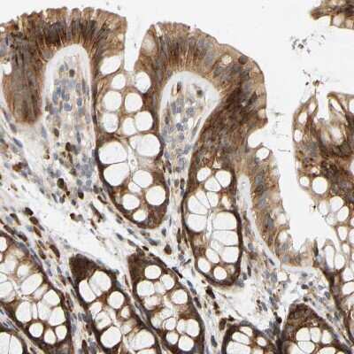 Immunohistochemistry-Paraffin: RPS14 Antibody [NBP1-84847]