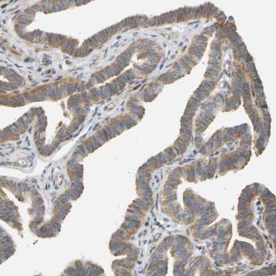 Immunohistochemistry-Paraffin: RPS14 Antibody [NBP1-84847]