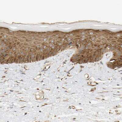 Immunohistochemistry-Paraffin: RPS14 Antibody [NBP1-84847]
