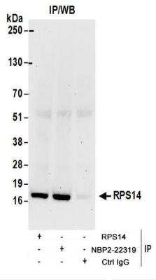 Immunoprecipitation: RPS14 Antibody [NBP2-22319]