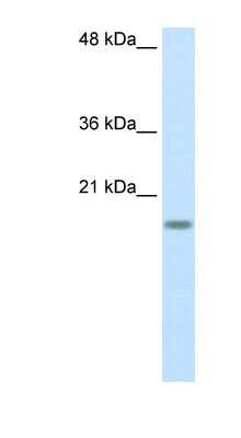 Western Blot: RPS14 Antibody [NBP1-57365]