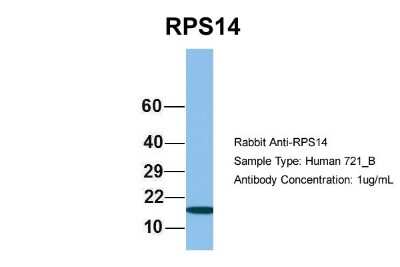 Western Blot: RPS14 Antibody [NBP1-57365]