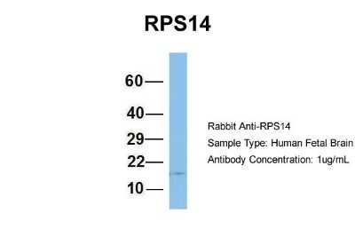 Western Blot: RPS14 Antibody [NBP1-57365]