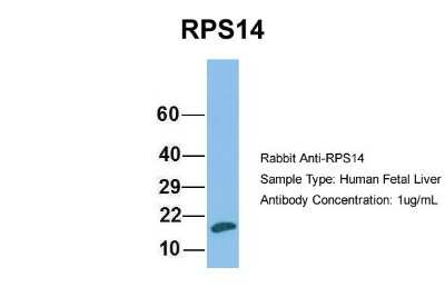 Western Blot: RPS14 Antibody [NBP1-57365]