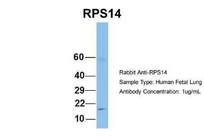Western Blot: RPS14 Antibody [NBP1-57365]