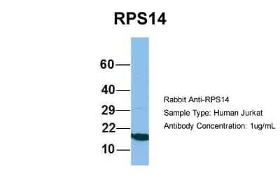 Western Blot: RPS14 Antibody [NBP1-57365]