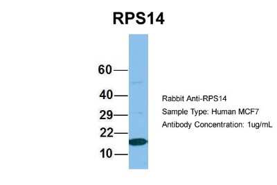 Western Blot: RPS14 Antibody [NBP1-57365]