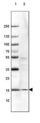 Western Blot: RPS14 Antibody [NBP1-84847]