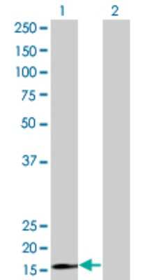 Western Blot: RPS15 Antibody (4H8) [H00006209-M01]