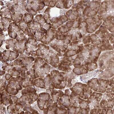 Immunohistochemistry-Paraffin: RPS15 Antibody [NBP2-33717]