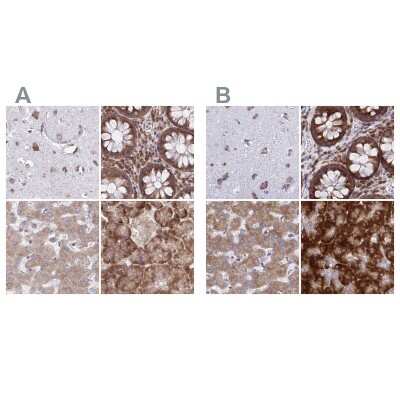 Immunohistochemistry-Paraffin: RPS15 Antibody [NBP2-33717]