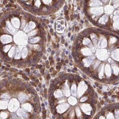 Immunohistochemistry-Paraffin: RPS15 Antibody [NBP2-33717]
