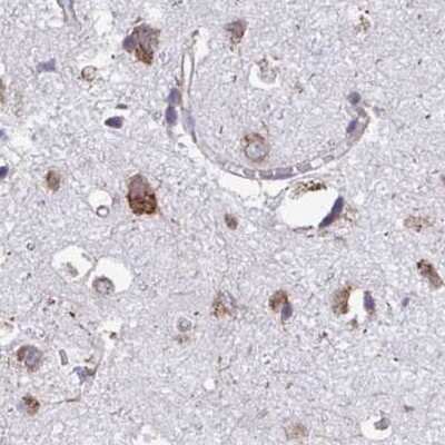 Immunohistochemistry-Paraffin: RPS15 Antibody [NBP2-33717]