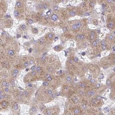 Immunohistochemistry-Paraffin: RPS15 Antibody [NBP2-33717]