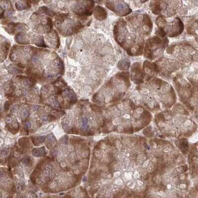 Immunohistochemistry-Paraffin: RPS15 Antibody [NBP2-33717]