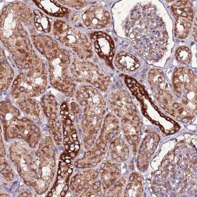 Immunohistochemistry-Paraffin: RPS15A Antibody [NBP1-92351]